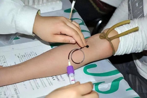 线下配资 高血脂与吃水果有关？医生提醒：血脂飙升，吃水果4不要